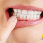 Traditional Remedies for Yellow Teeth