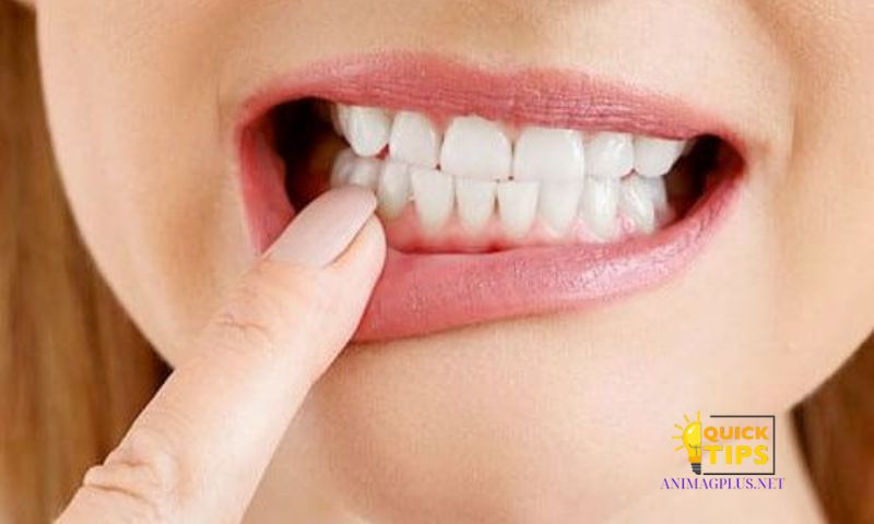 Traditional Remedies for Yellow Teeth