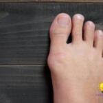 Tips for Treating Toe Cramps