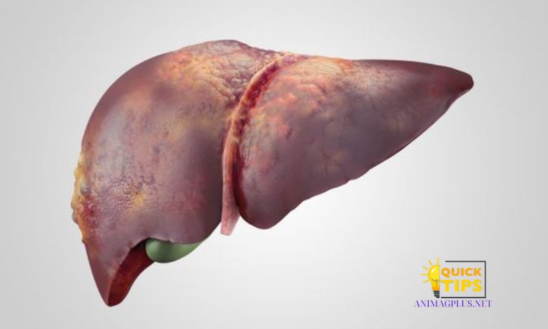 Understanding Fatty Liver: An Overview